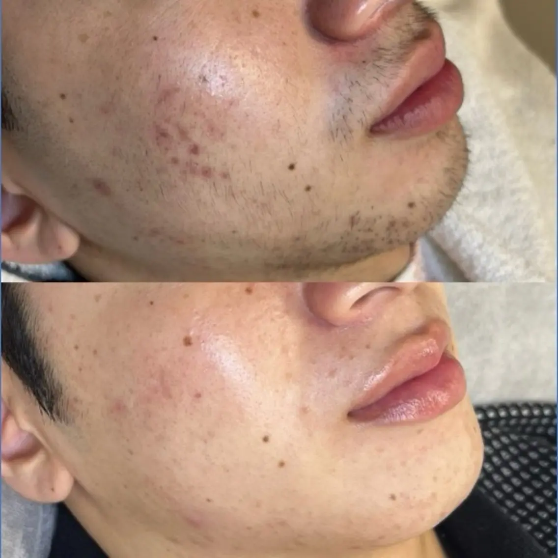 メンズ BEBROW 堀江の眉毛・アイブロウイメージ