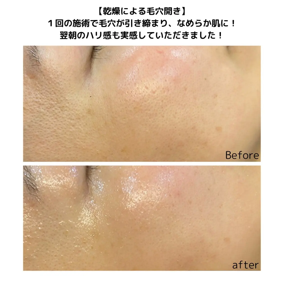 leolo武蔵浦和 肌質改善&脱毛のエステ・リラクイメージ