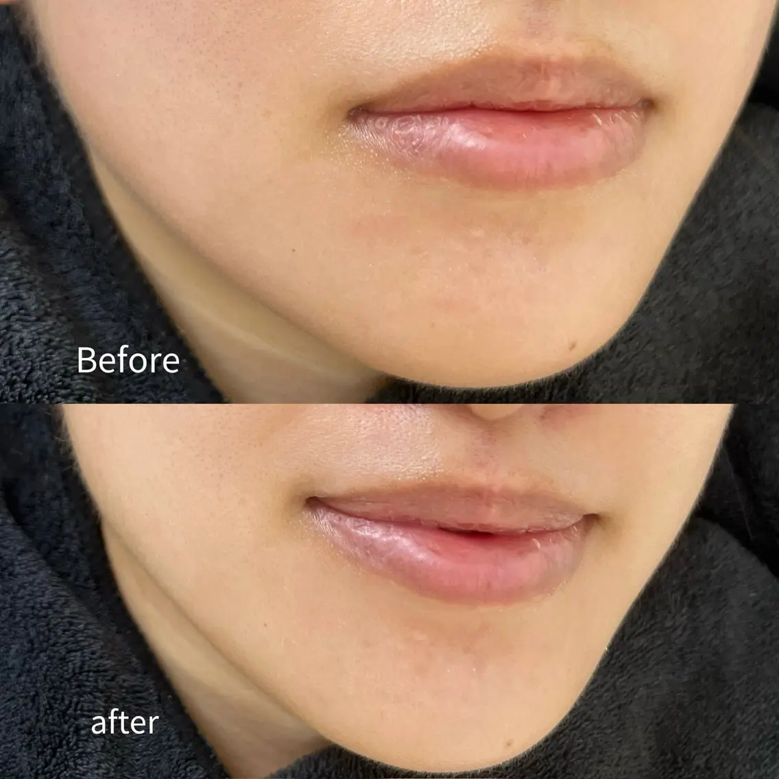 エステ Balance facialのその他イメージ