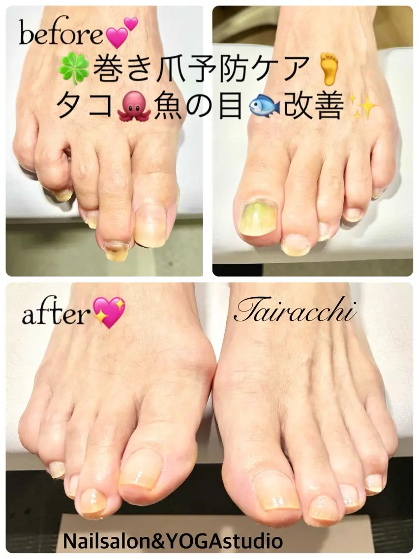 ネイル フットネイル フットネイル Tairacchi タイラッチのネイルデザイン