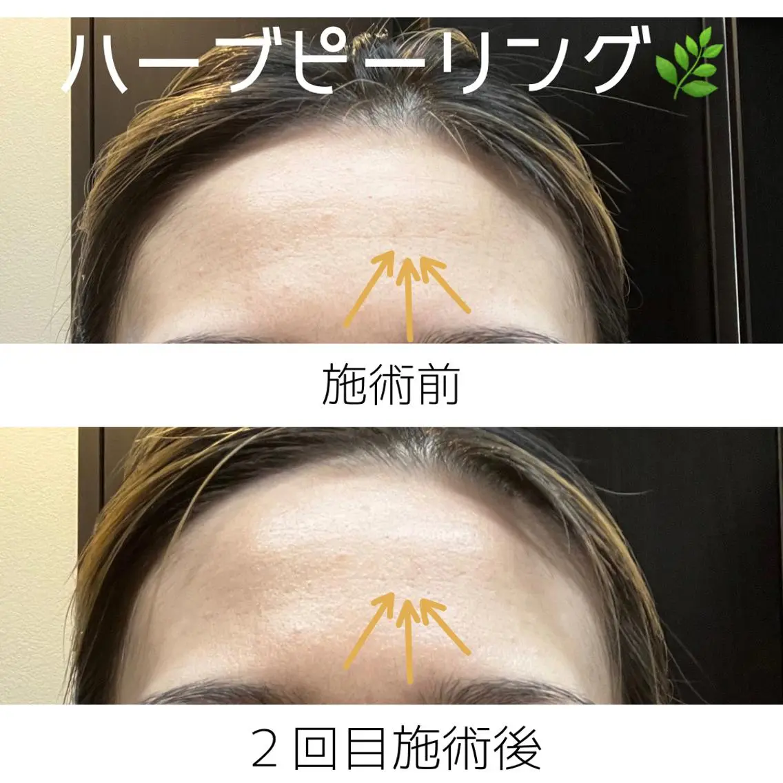 鍼灸サロン Sakuraのエステ・リラクイメージ