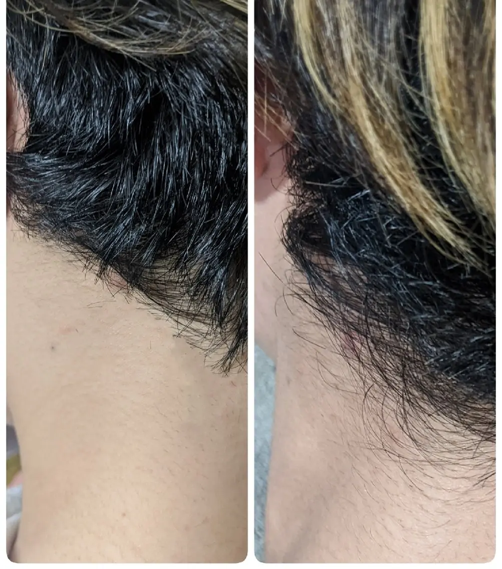 脱毛 private salon OPALのエステ・リラクイメージ
