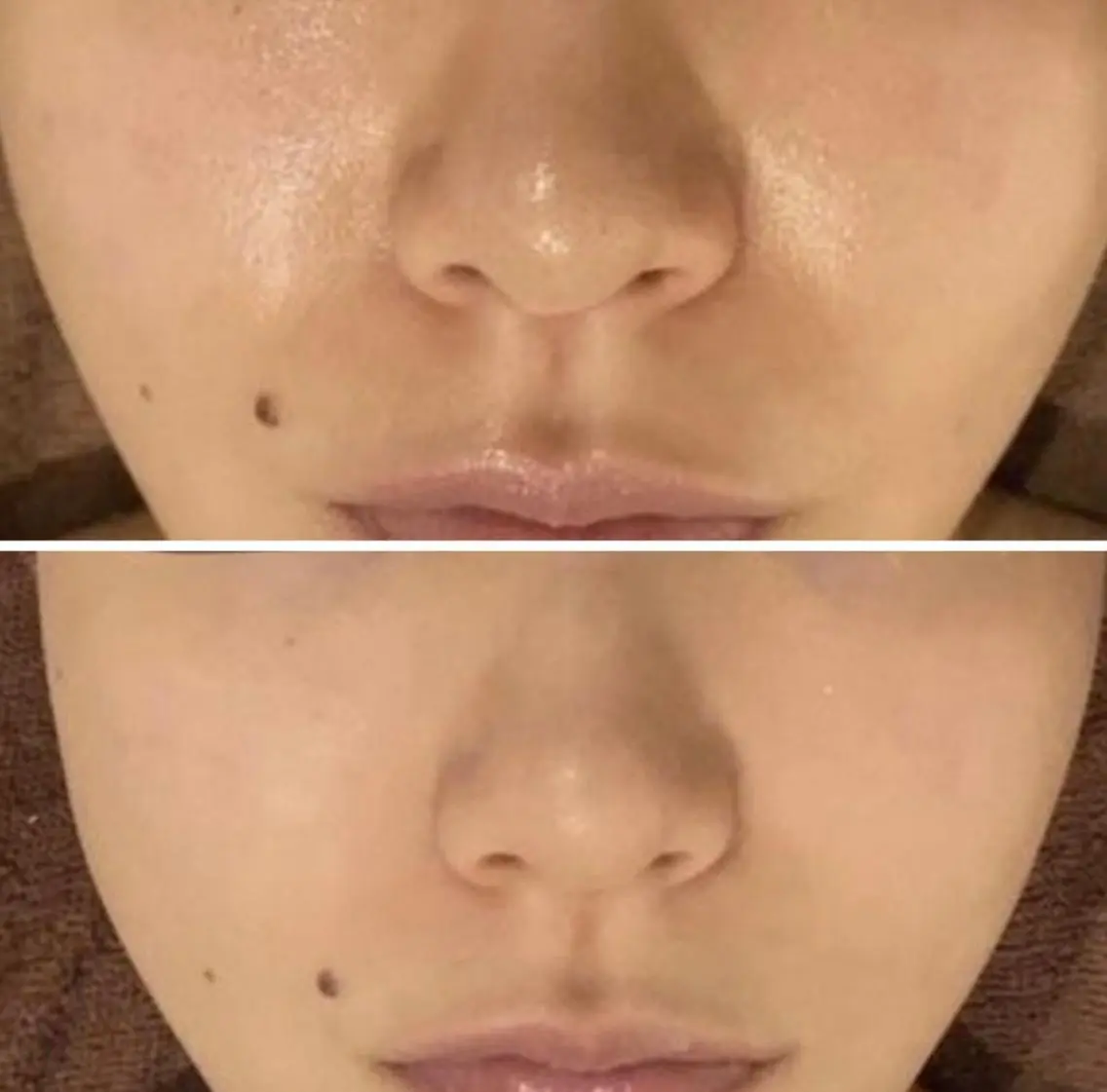 セミロング カラー パーマ ヘアアレンジ メンズ キッズ ネイル マツエク・マツパ アイブロウ 3か月で肌革命👼 ニキビ専門店💫のエステ・リラクイメージ