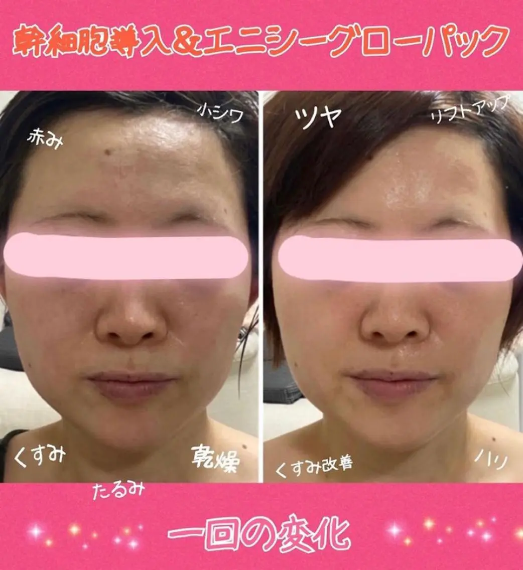 ショート カラー パーマ ヘアアレンジ メンズ キッズ ネイル マツエク・マツパ 痩身&ボディ 結果出し🌟丹野のエステ・リラクイメージ