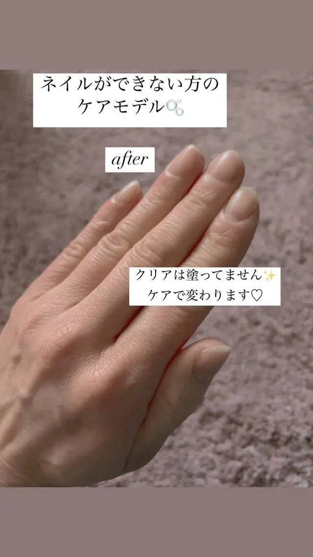 ネイルができない方のケアのみメニューの写真