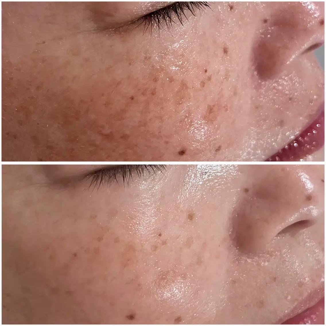 🈹60%off✨水光肌✨モデリングパック付き💆‍♀️最強肌質改善フェイシャル80分の写真