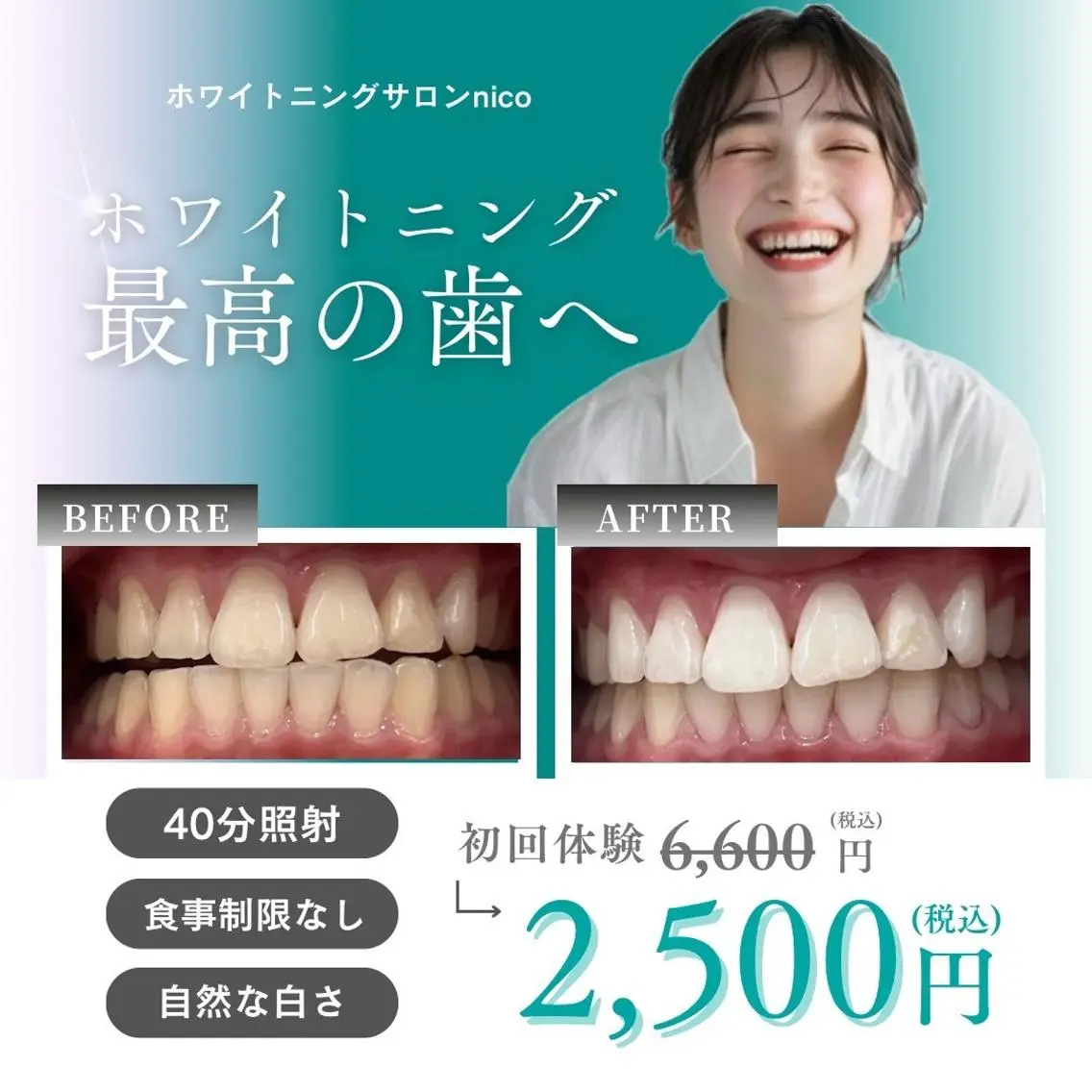 ミディアム カラー 学生 その他 ホワイトニングサロン nico西葛西店のその他イメージ
