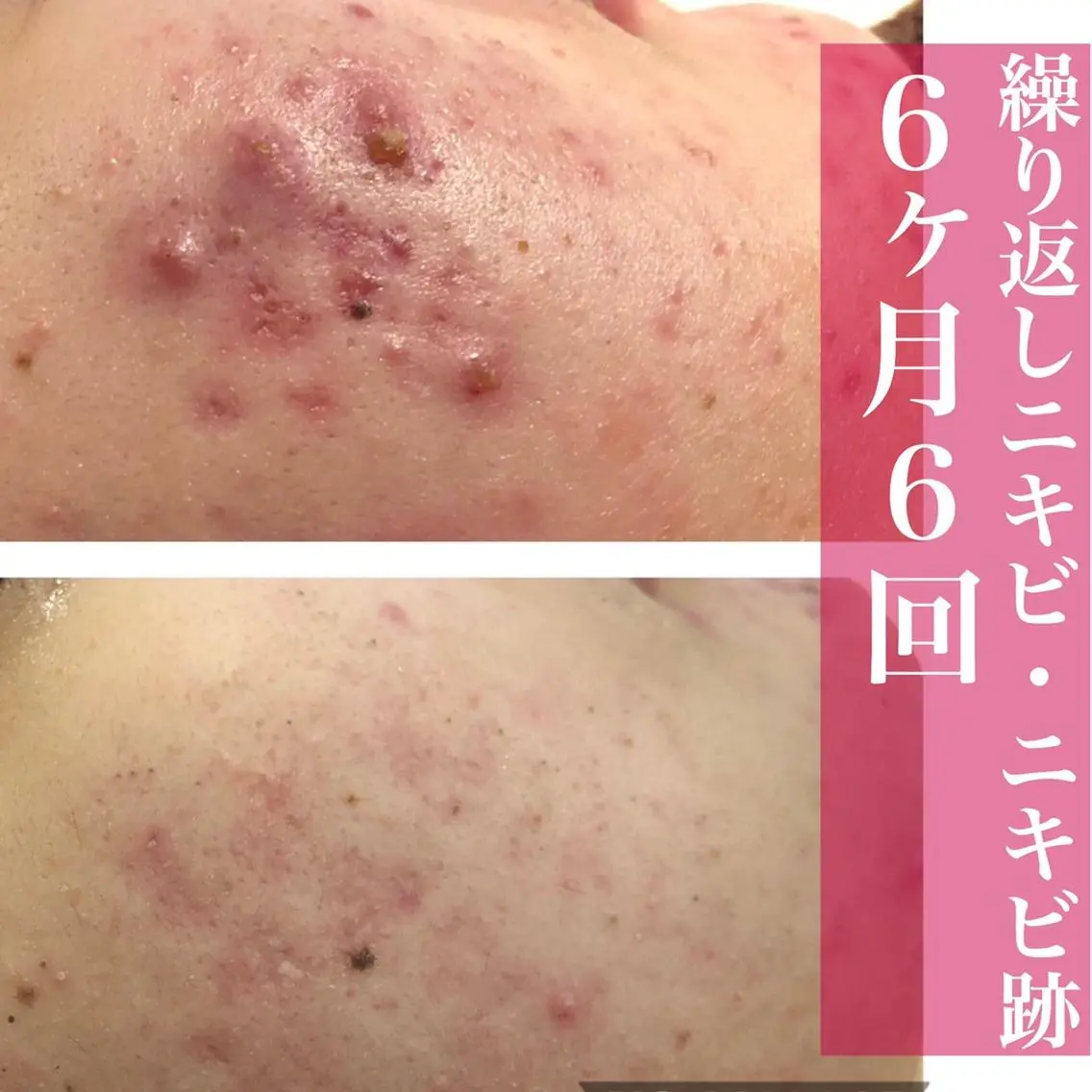 ミディアム カラー パーマ ヘアアレンジ メンズ ネイル マツエク・マツパ アイブロウ ニキビ・肌質改善専門 ♡人生が変わるサロンのエステ・リラクイメージ