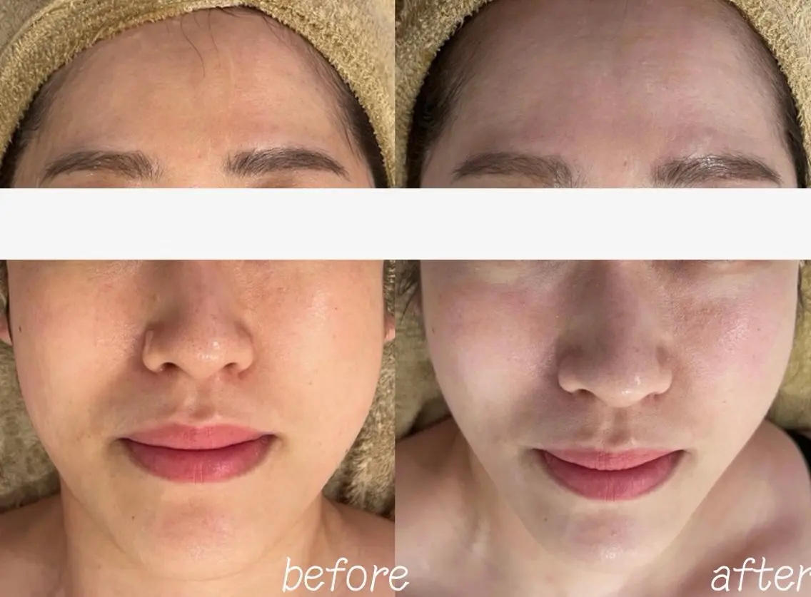 エステ clinical salon enのエステ・リラクイメージ