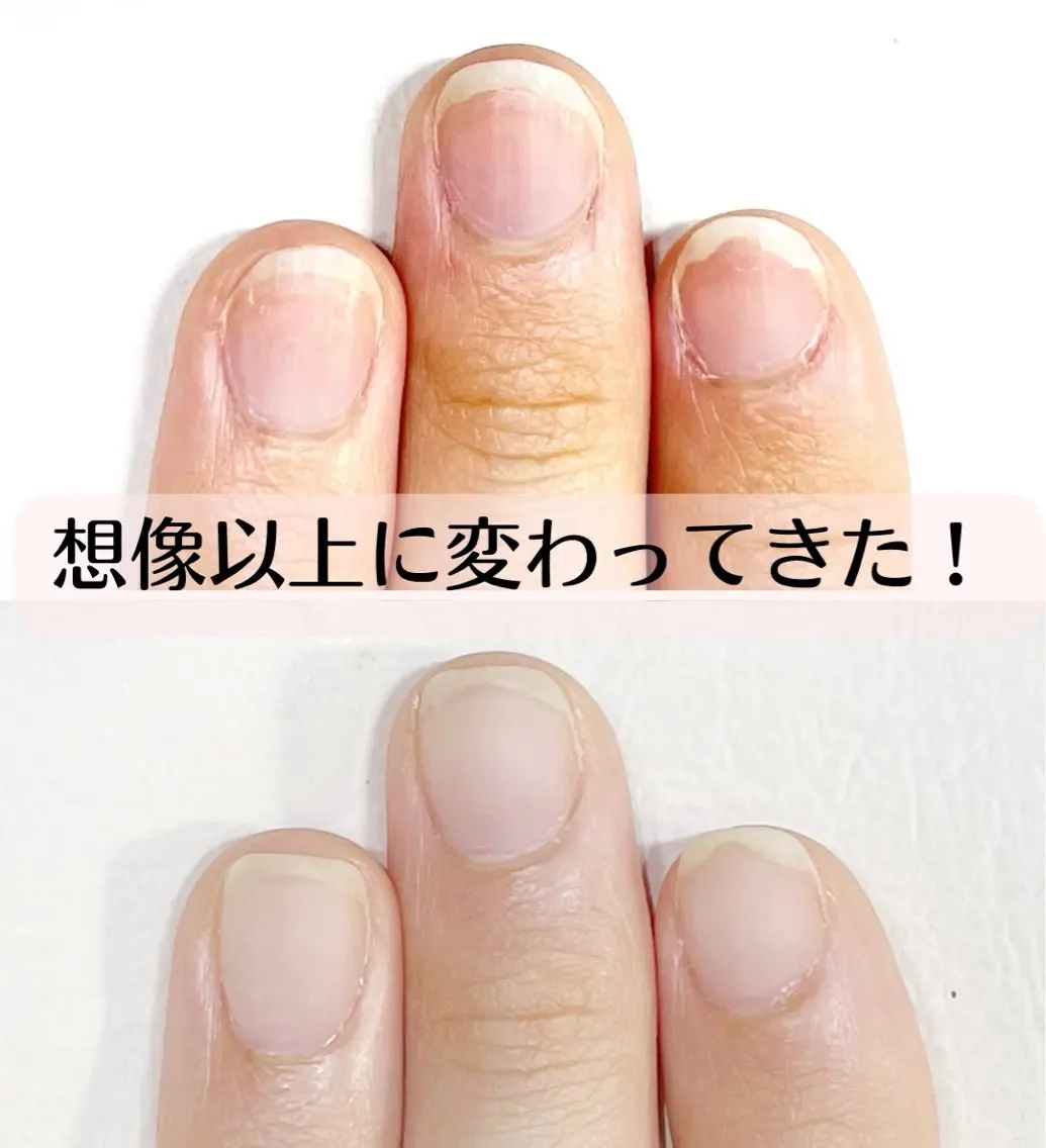 ネイル 深爪・巻き爪 専門サンセリテのネイルデザイン
