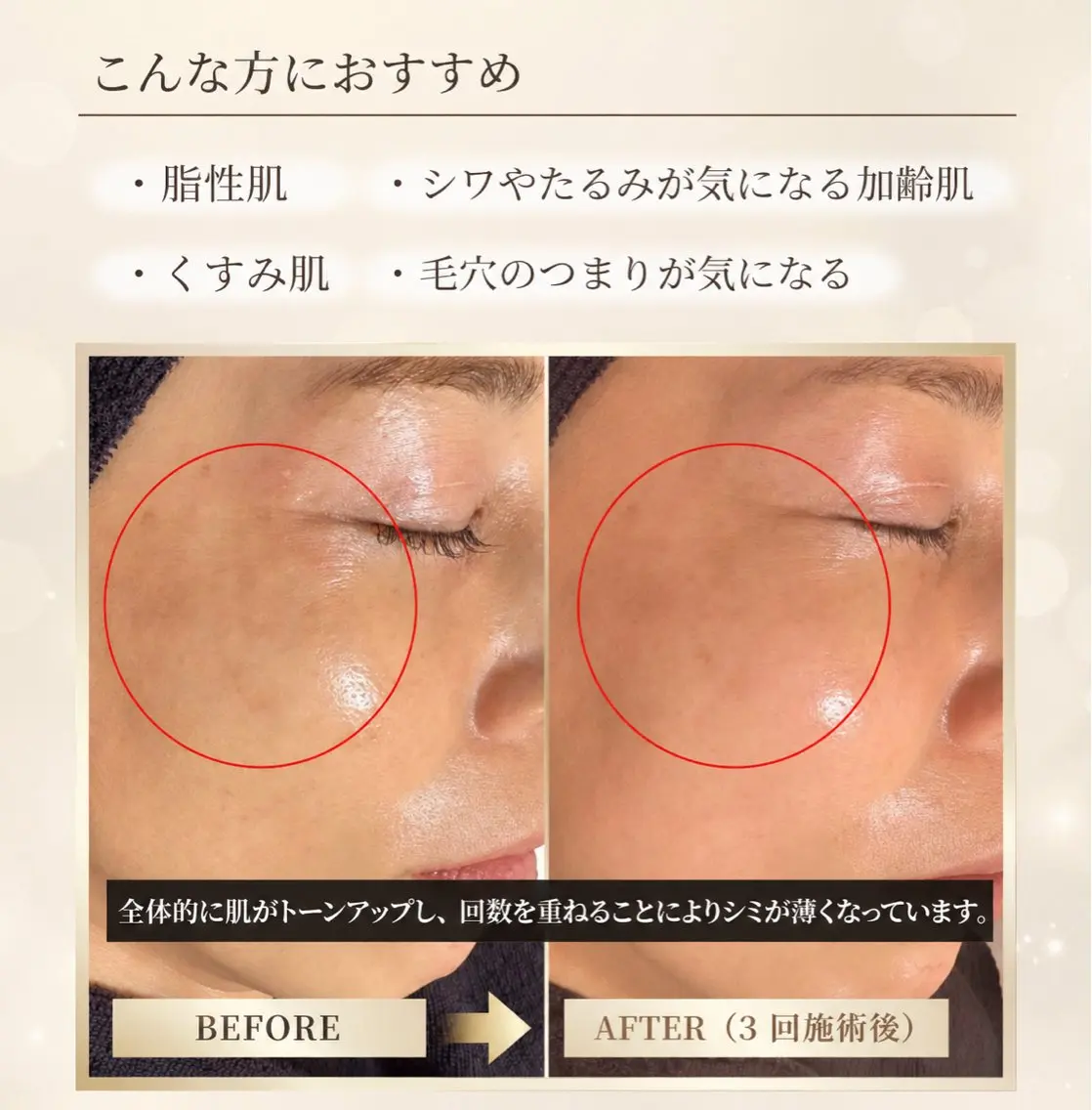 エステ リラク 肌質改善サロン réposのその他イメージ