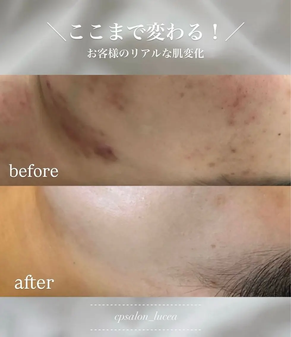 CPサロン Luceaのエステ・リラクイメージ