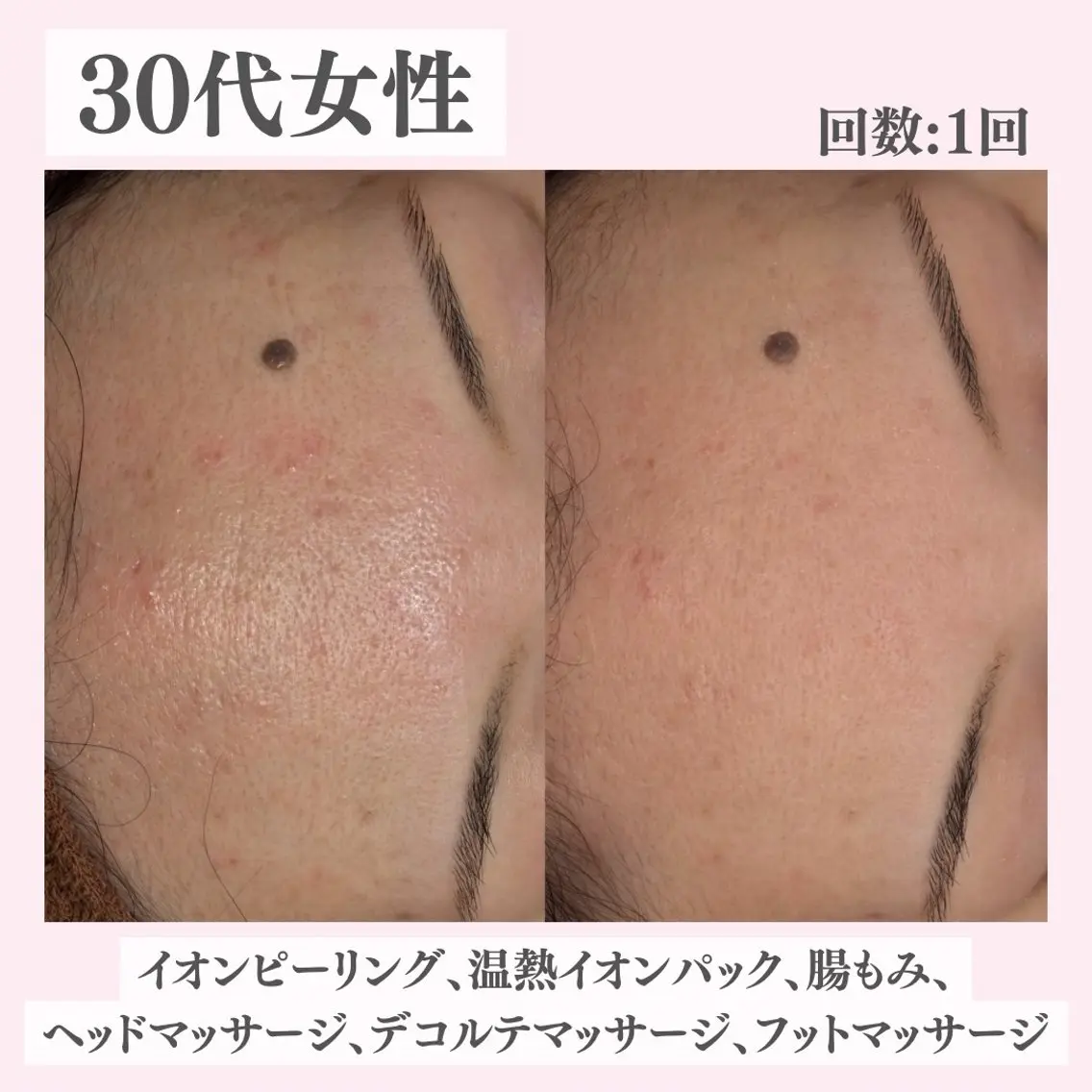 エステ リラク ニキビ・肌質改善専門 ♡人生が変わるサロンのエステ・リラクイメージ