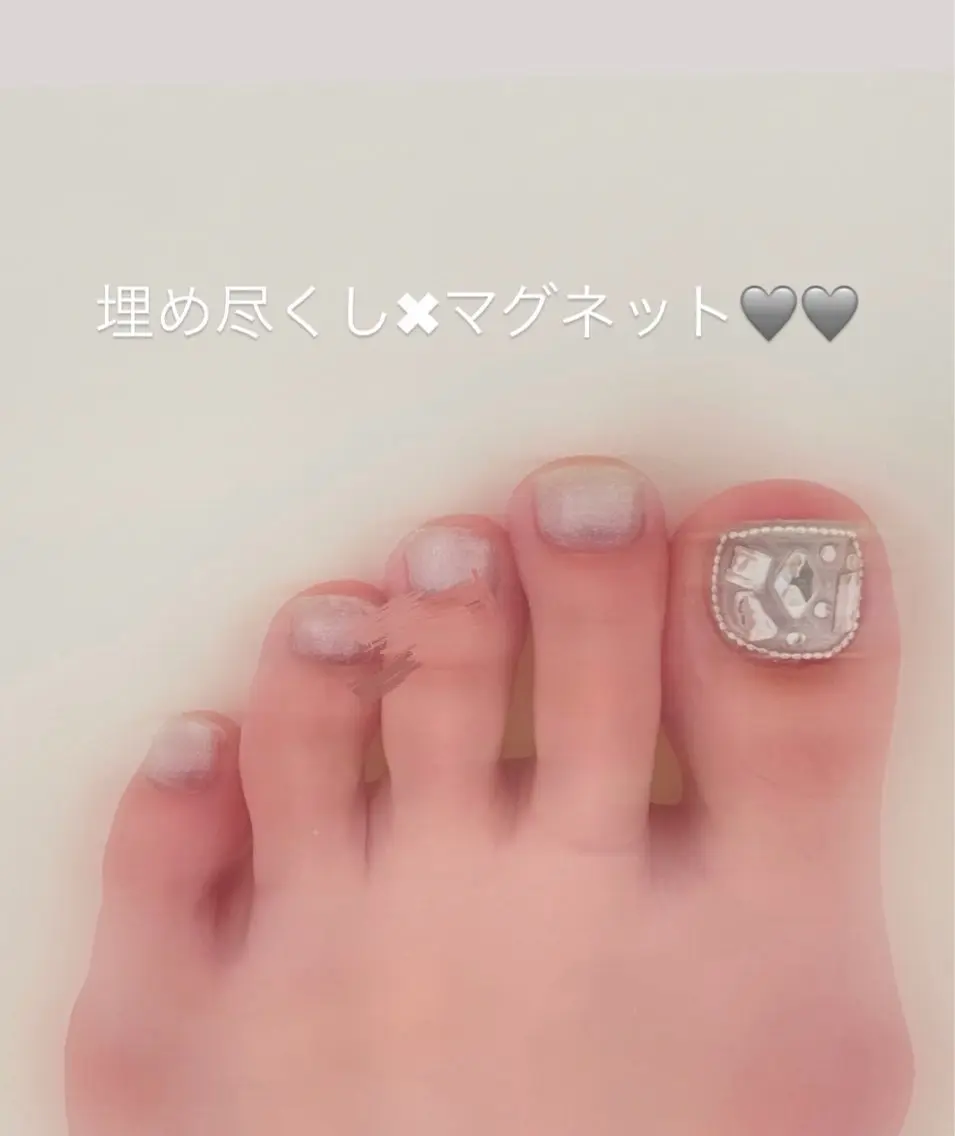 6月限定【耳ツボ6粒+お任せネイル】の写真