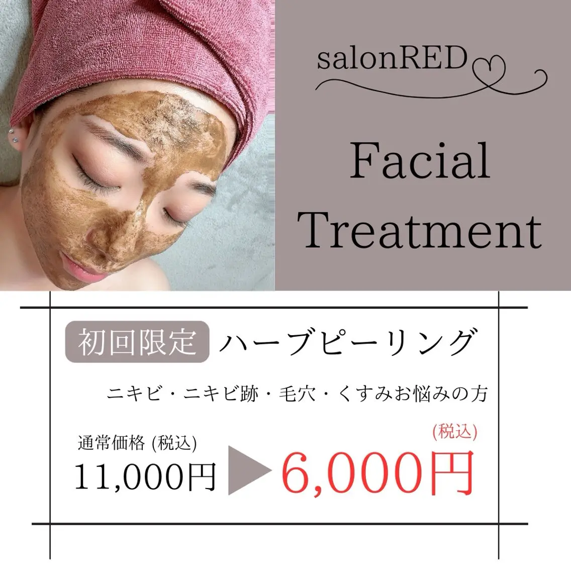 minimo限定🩵【ニキビケア】ハーブピーリング剥離なし🌱～新しいお肌へ生まれ変わる～の写真