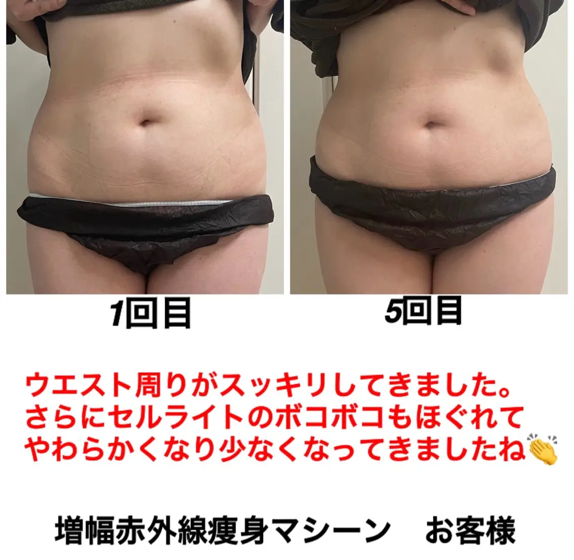 エステ ネイル・エステサロン UILANIのエステ・リラクイメージ