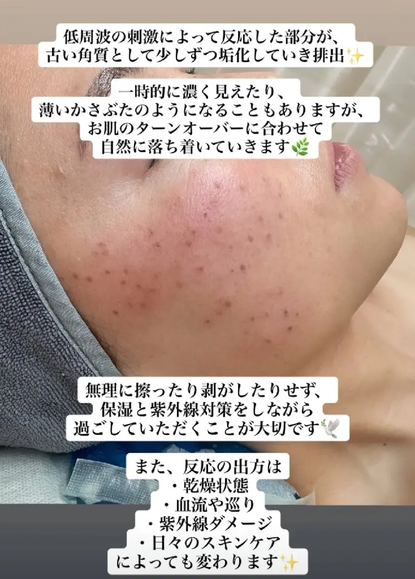 SPOT.com  シミケア専門店のエステ・リラクイメージ