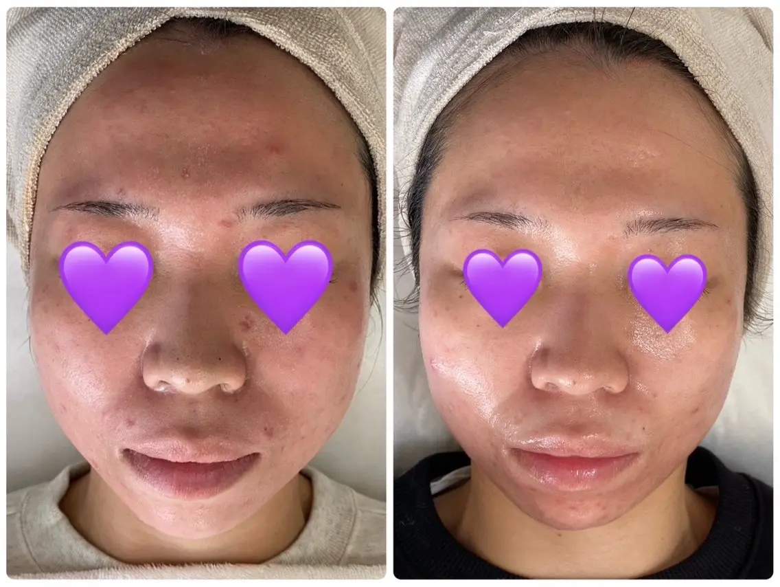 エステ COCO beautyサロンのエステ・リラクイメージ