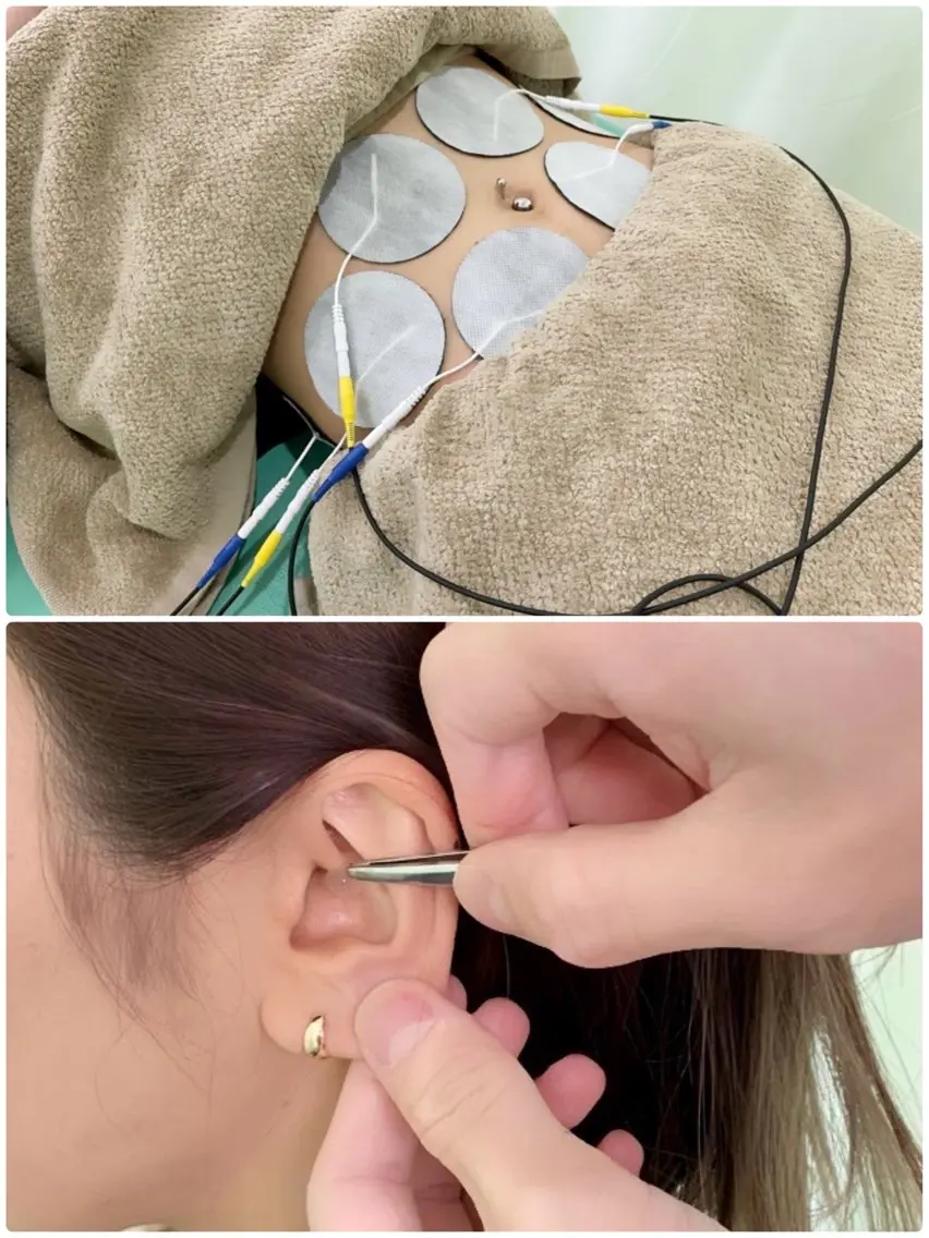 【EMSトレーニング+耳鍼👂】人気のセットメニュー✨耳ツボ刺激を入れる事で食欲減退❤️🔥の写真