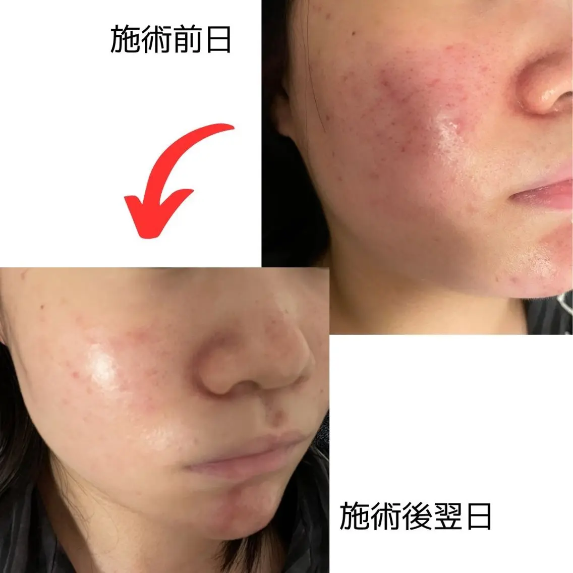 脱毛 彭 伸子のエステ・リラクイメージ
