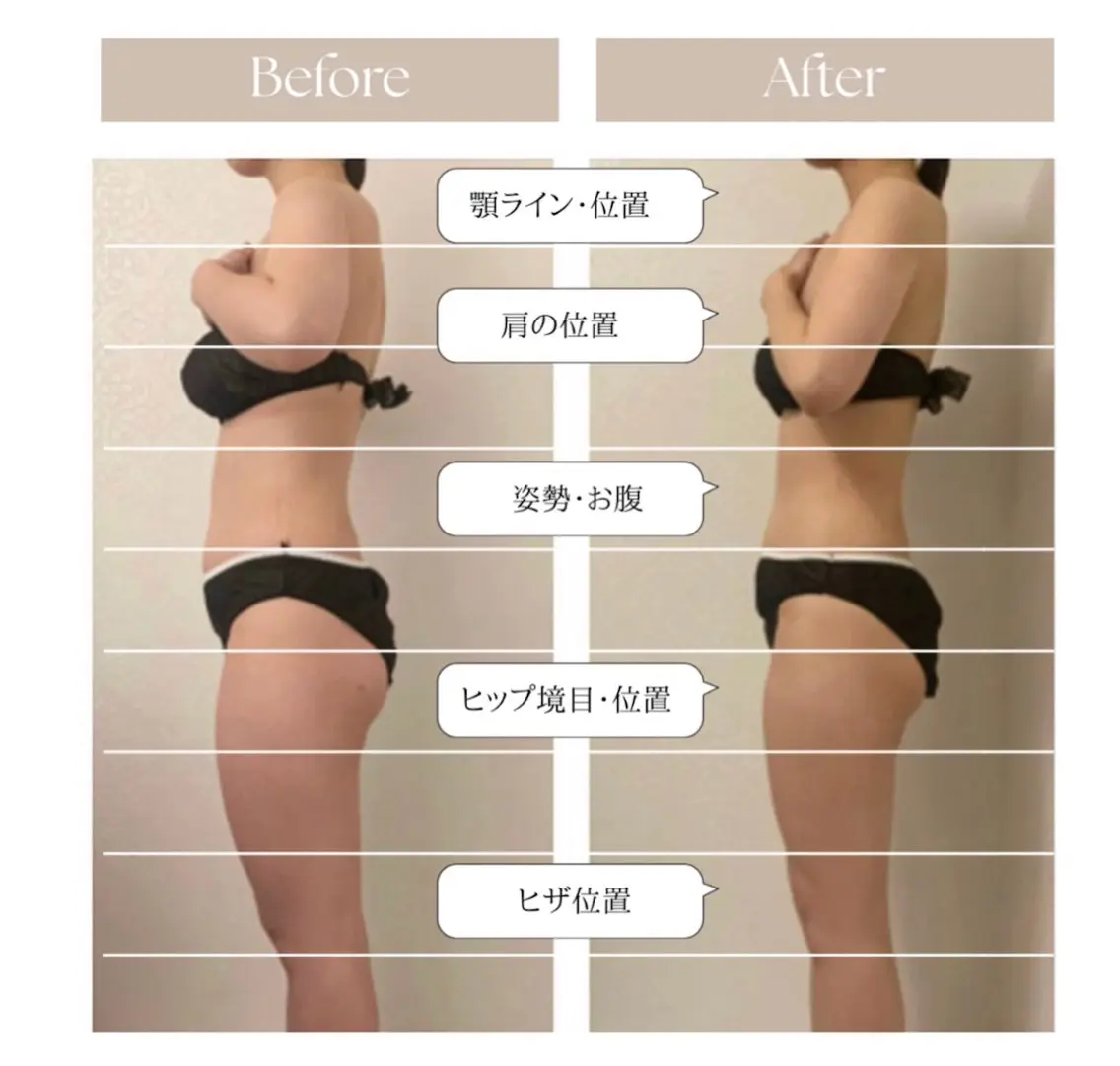 【駆け込み痩身】ノーメス4Dボディ90分の写真