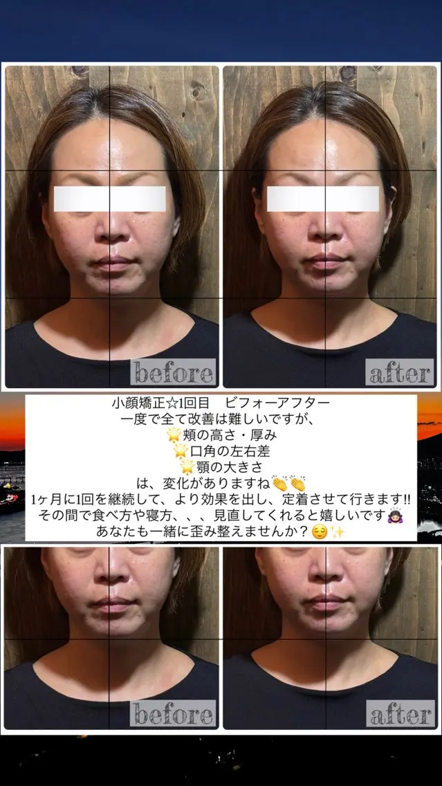 エステ リラク 💎後悔させない小顔 矯正💎イトヤマ🌱のエステ・リラクイメージ
