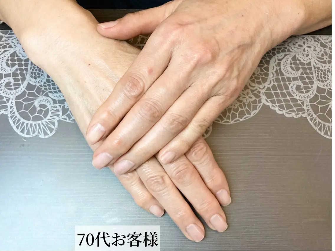 【手のしわ改善】ハンドケア&ネイルケア エイジングケア🌿120分(初回相談込み) 手の老化対策の写真