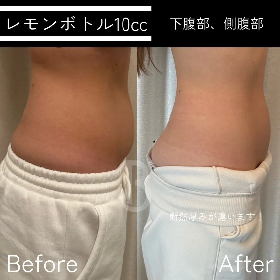 エステ Beauty salonBELLEのエステ・リラクイメージ
