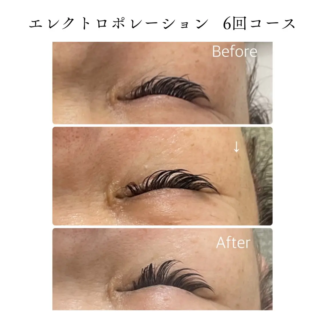 エステ TiALASH Estheticのエステ・リラクイメージ