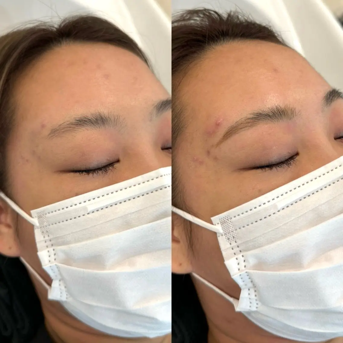 アイブロウ ワックス脱毛 その他(アイブロウ) 綾野 帆乃夏の眉毛・アイブロウイメージ