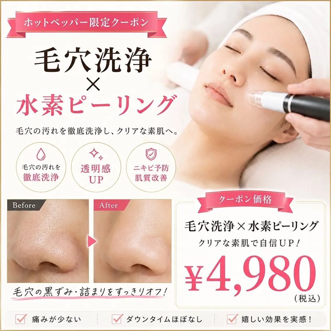 🌀毛穴洗浄🌀水素ピーリングで毛穴の黒ずみスッキリ👃✨の写真