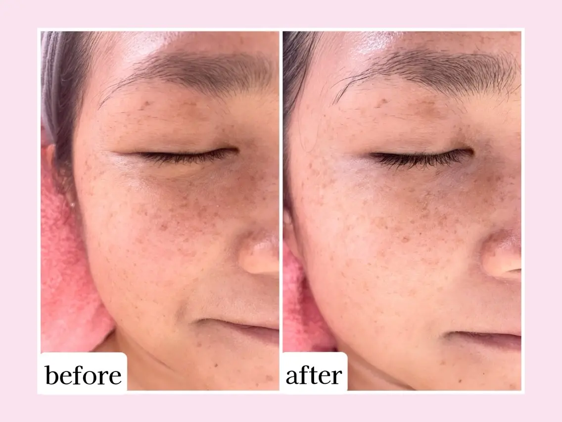💜Karen PrivateSpaのエステ・リラクイメージ