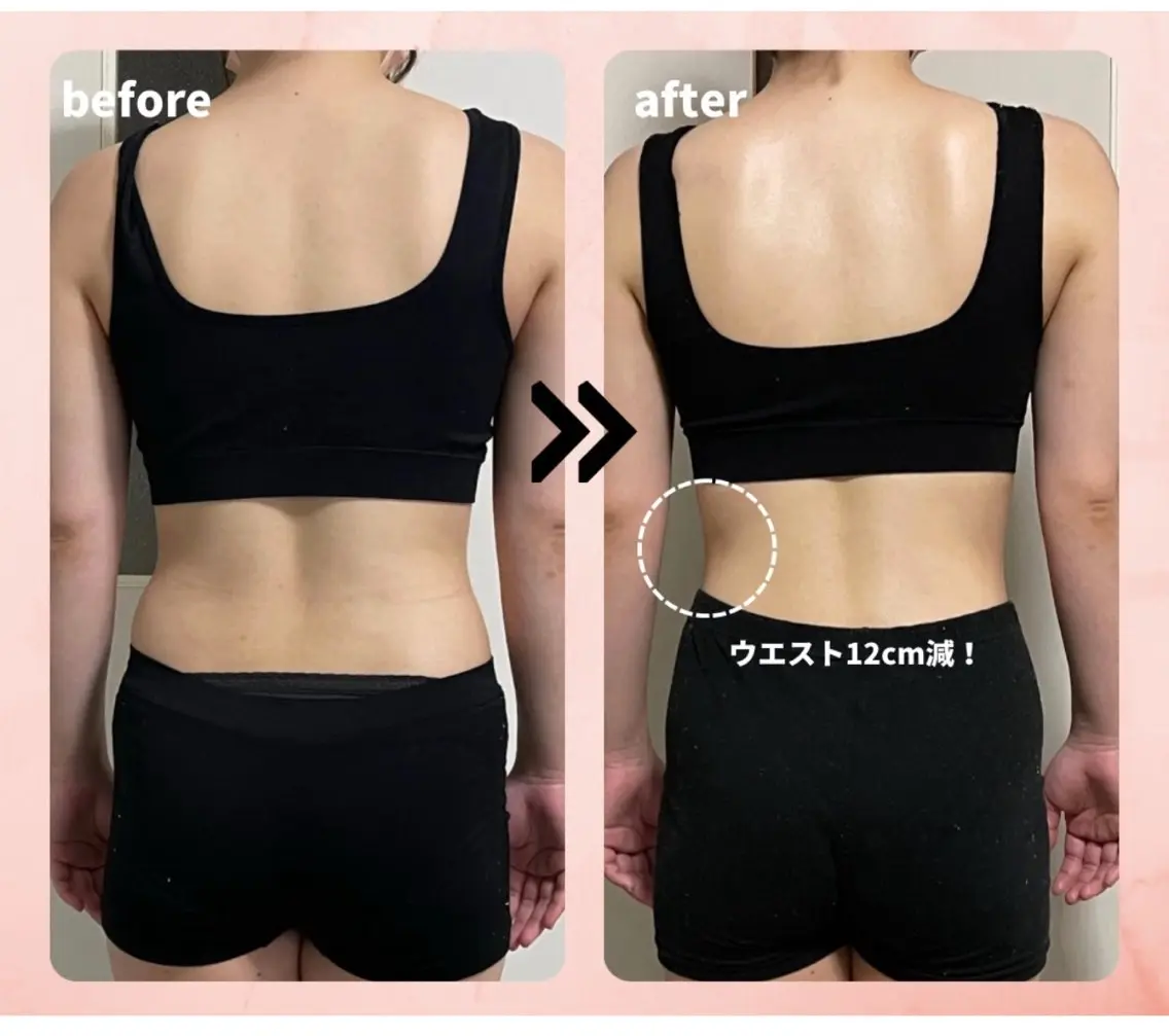 🌈女性限定 🌈専用機器を使ったリンパエステ。『どんな施術？』と気になる方まずは一度体験ください。の写真
