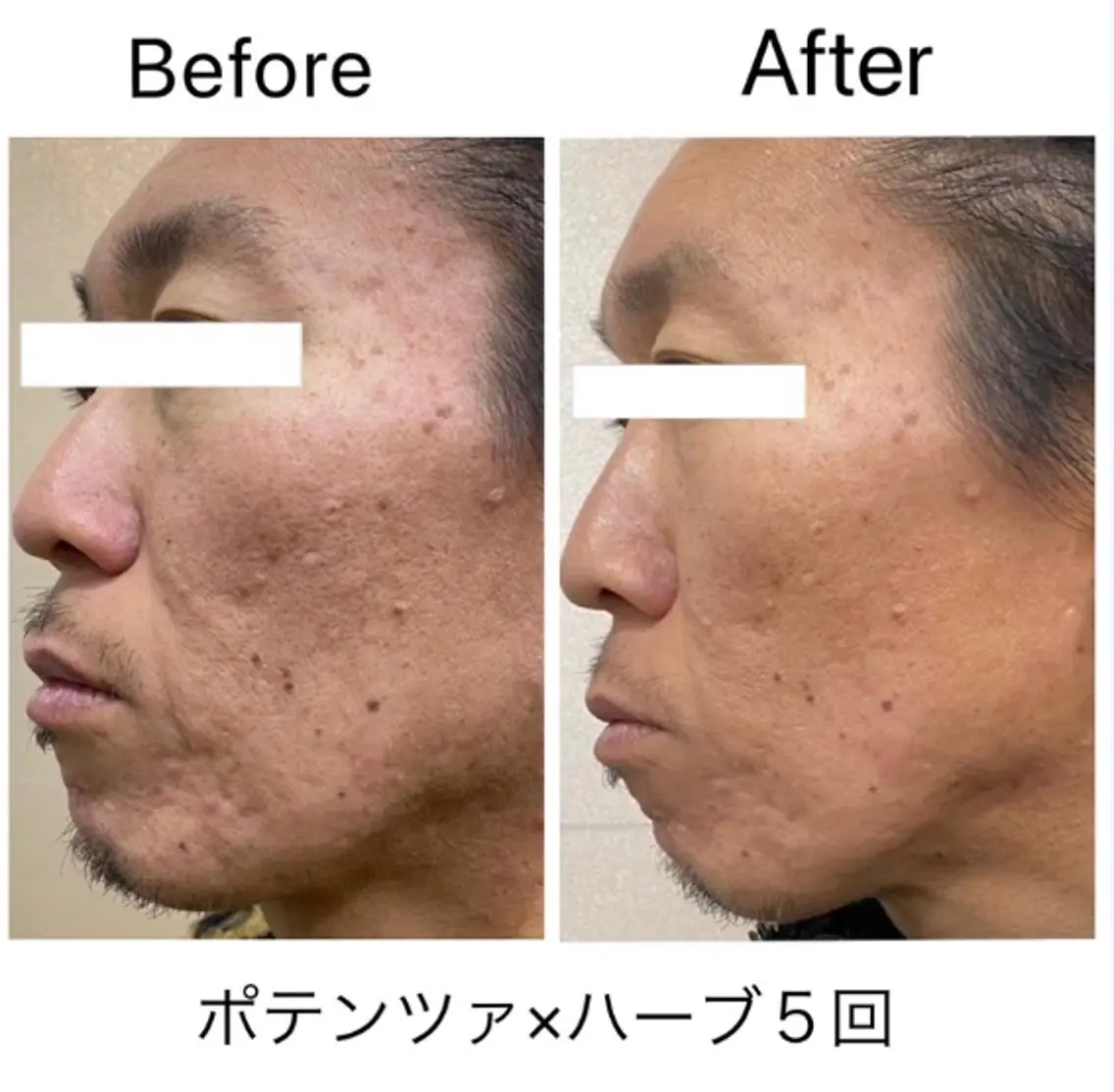 エステ 肌管理 OGUMOのエステ・リラクイメージ