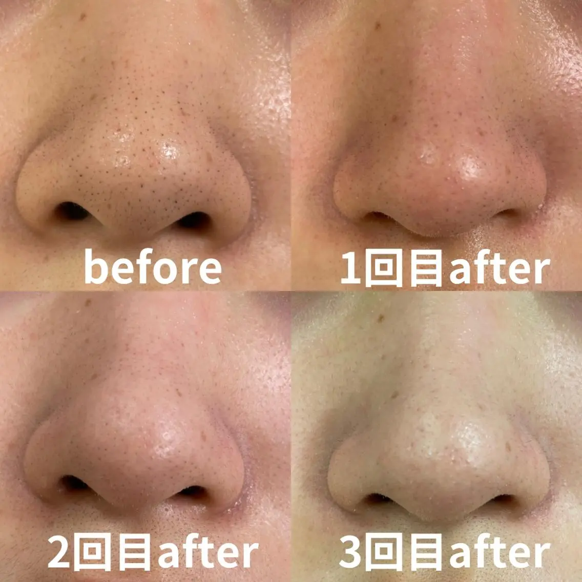 mish eyebrowのエステ・リラクイメージ