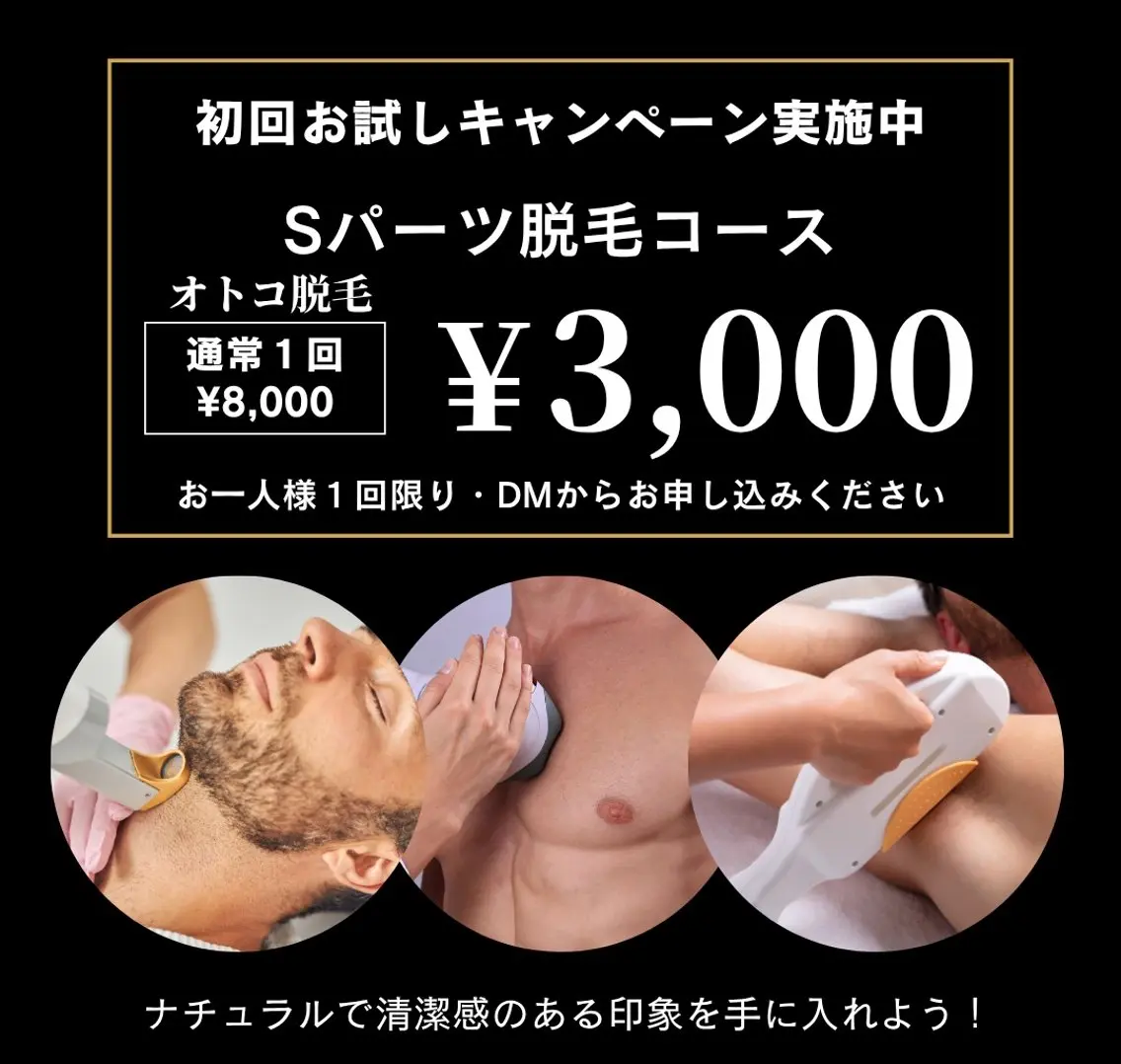 ヒゲ🥸脱毛したい!男性必見👀‼️初めてでも安心♪Sパーツ脱毛1回¥3,000の写真