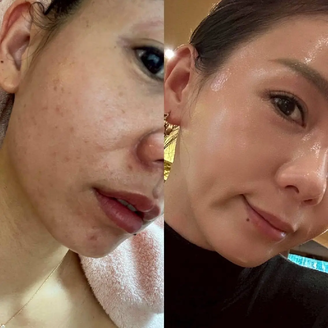 エステ 辻村 晴美のエステ・リラクイメージ