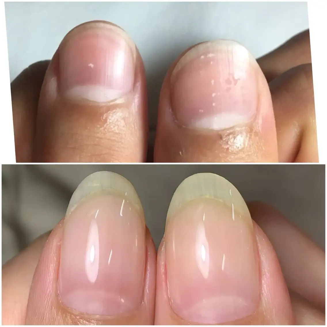 ネイル ハンドネイル 雀宮 自爪育成 Re.nail〜寺本のネイルデザイン