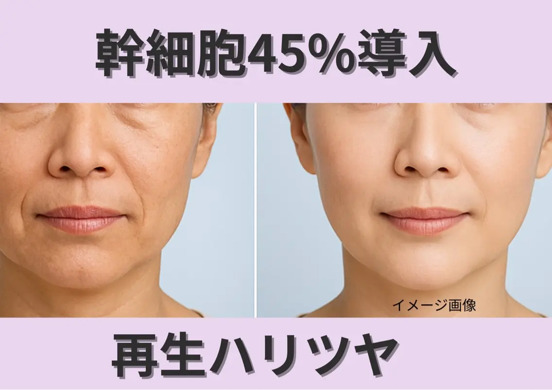 【くすみ肌を1回でリセット】幹細胞イオン導入×パック|透明感・ハリ・潤いを同時チャージ💎の写真
