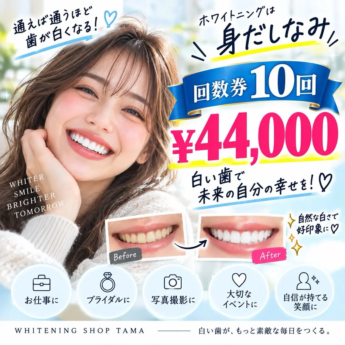 🦷通うほど白い歯へ✨セルフホワイトニング10回券¥44,000💕の写真