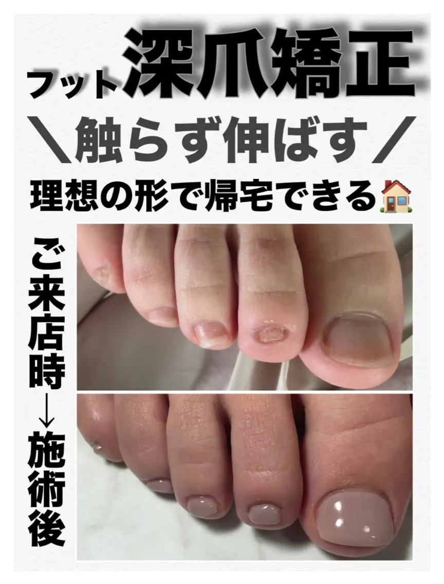 ネイル フットネイル nail salon petillantのネイルデザイン