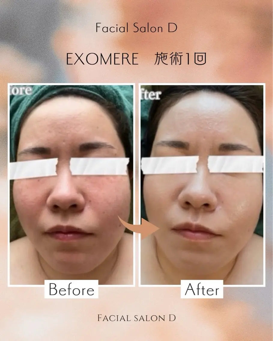 facial salon D 吉沢のエステ・リラクイメージ