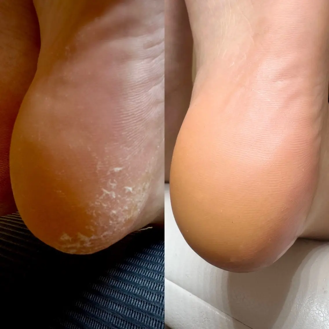 ＼冬のフットケア⛄️❄️.*／ツルツルかかとへ～👣✨️の写真
