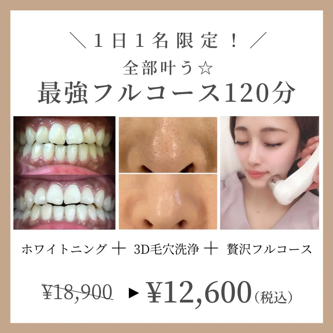 全部叶う!☆最強フルコース120分(セルフホワイトニング+3D毛穴洗浄+小顔フェイシャル+オプション4箇所)の写真