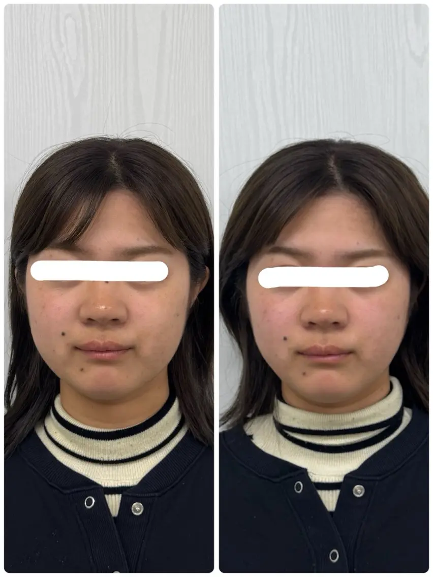 美容鍼×小顔矯正 ×美容整体 浜川泰仁のエステ・リラクイメージ