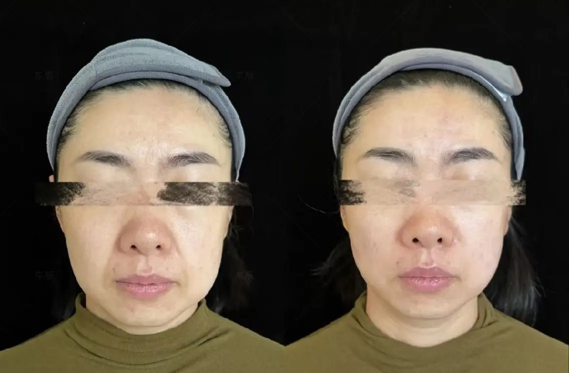 アイブロウ 眉毛ワックス脱毛 aliaハーブ水光店 エステティシャン募集のエステ・リラクイメージ
