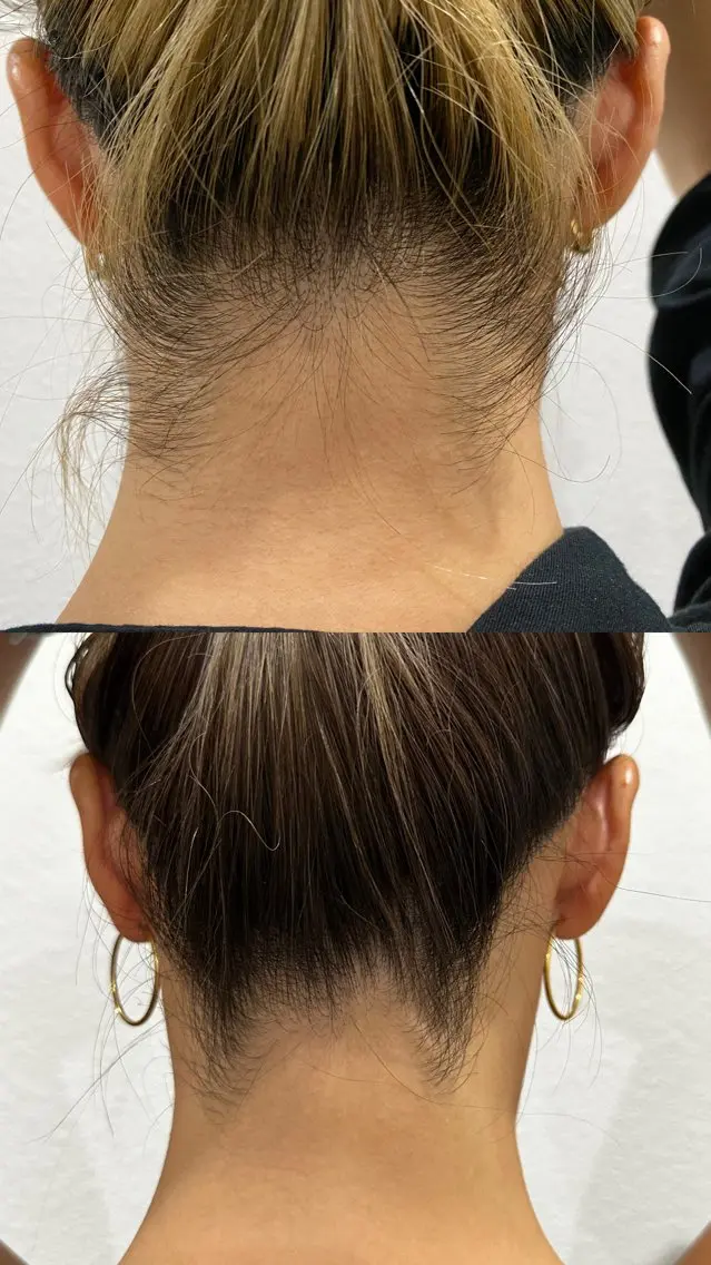 脱毛 パーソナル脱毛 GROOMのエステ・リラクイメージ