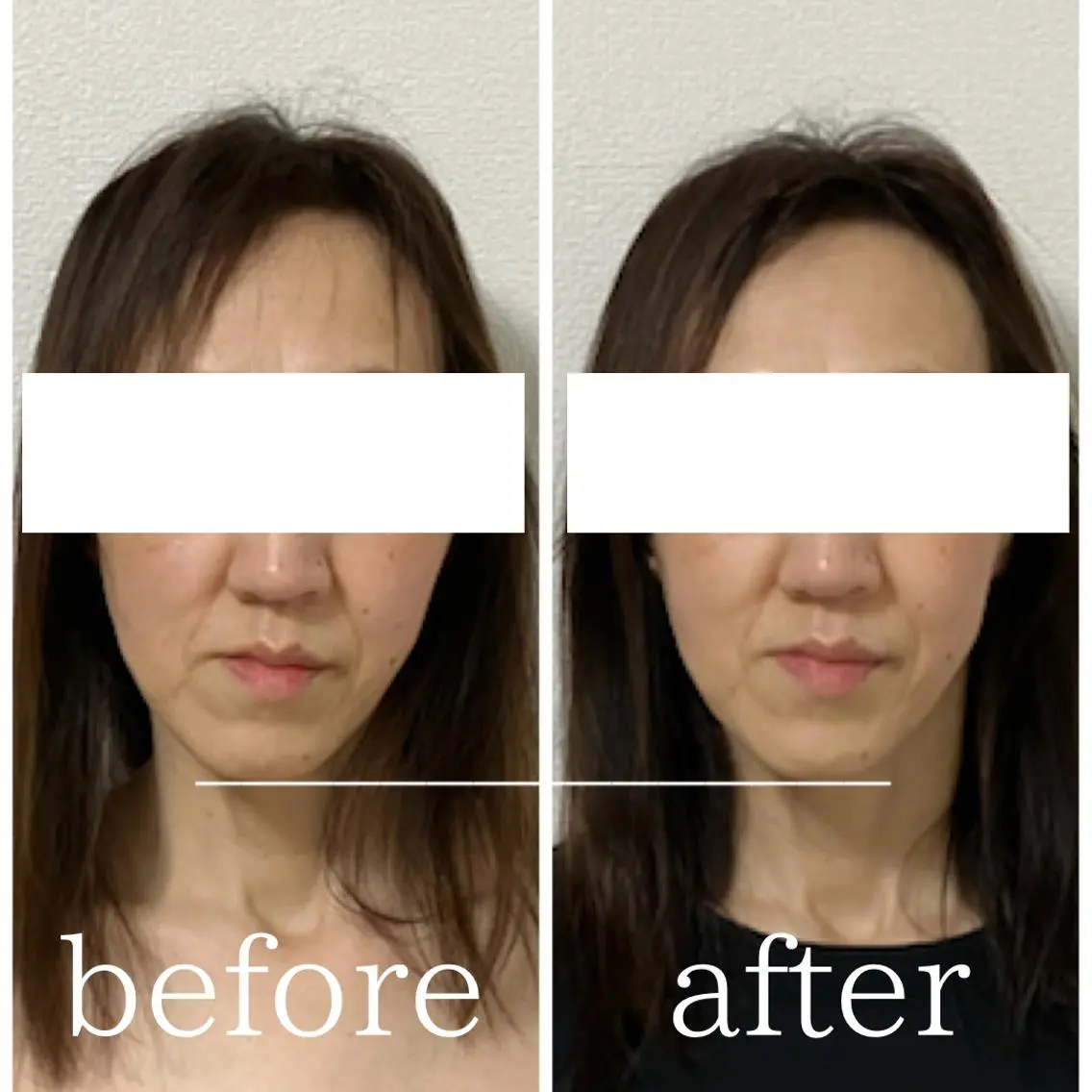 毛穴肌質ケアサロン Yourmeユアミーのエステ・リラクイメージ