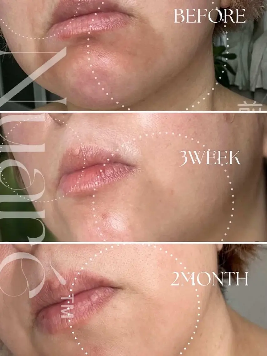 エステ eyelash salon SOLのマツエク・マツパデザイン