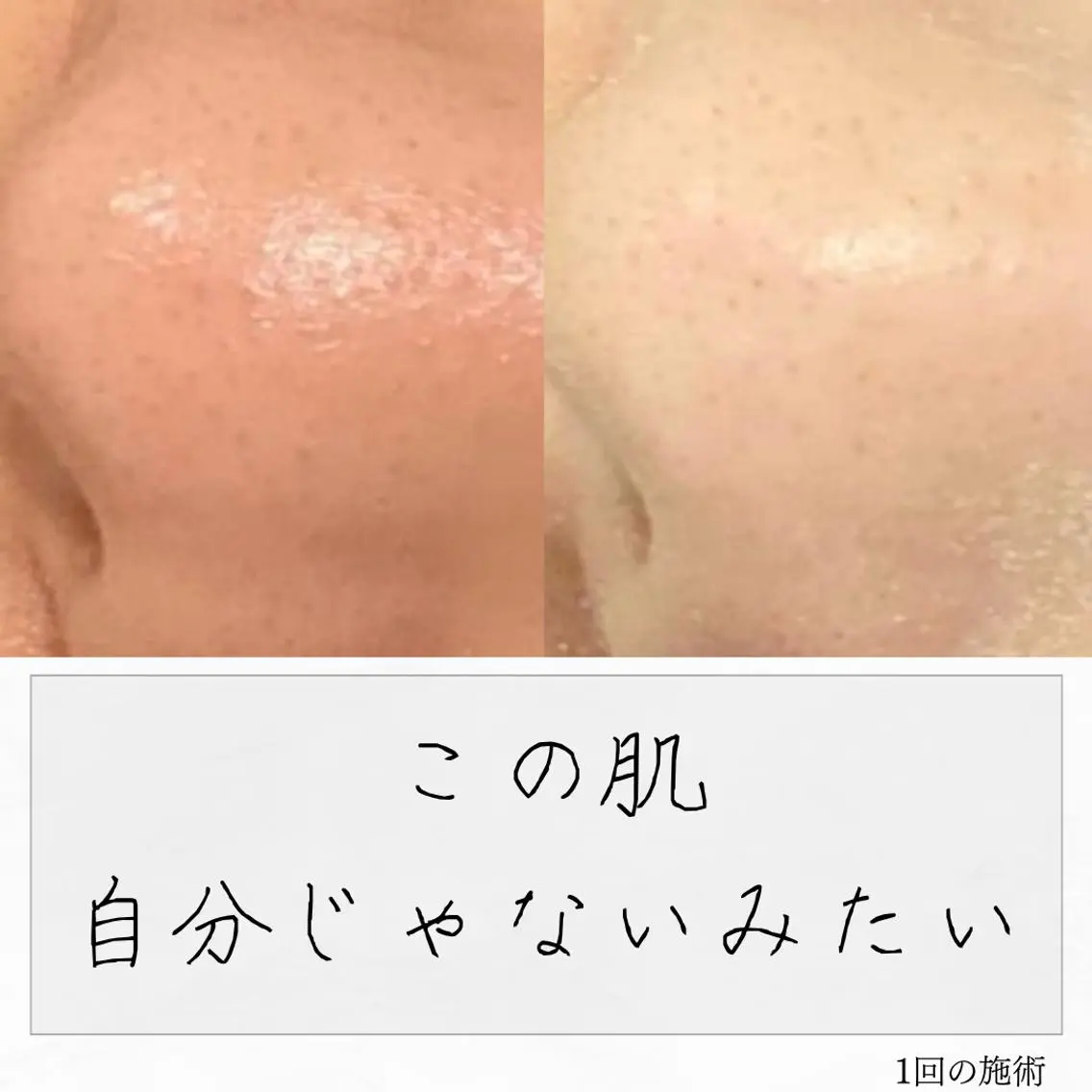 ニキビ経験者が施術 する専門サロン🌻のエステ・リラクイメージ